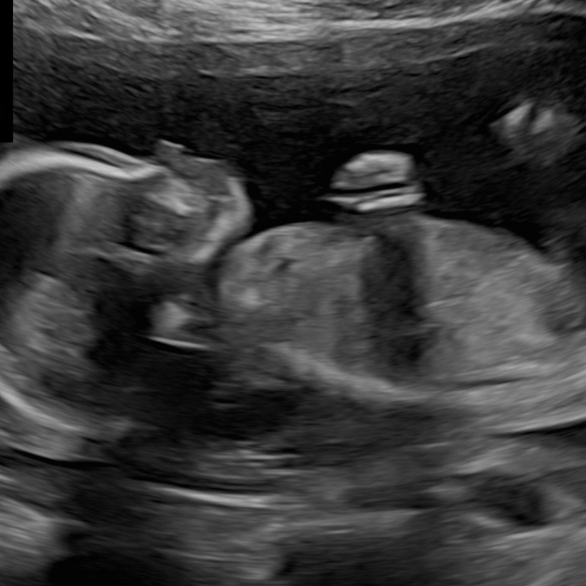 obituary photo for Josiah