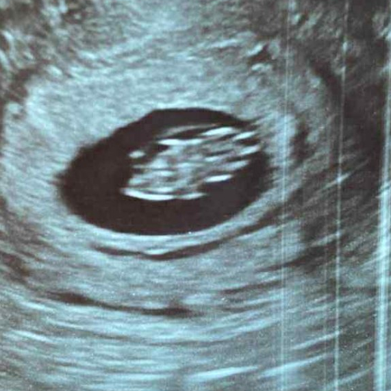 obituary photo for Baby